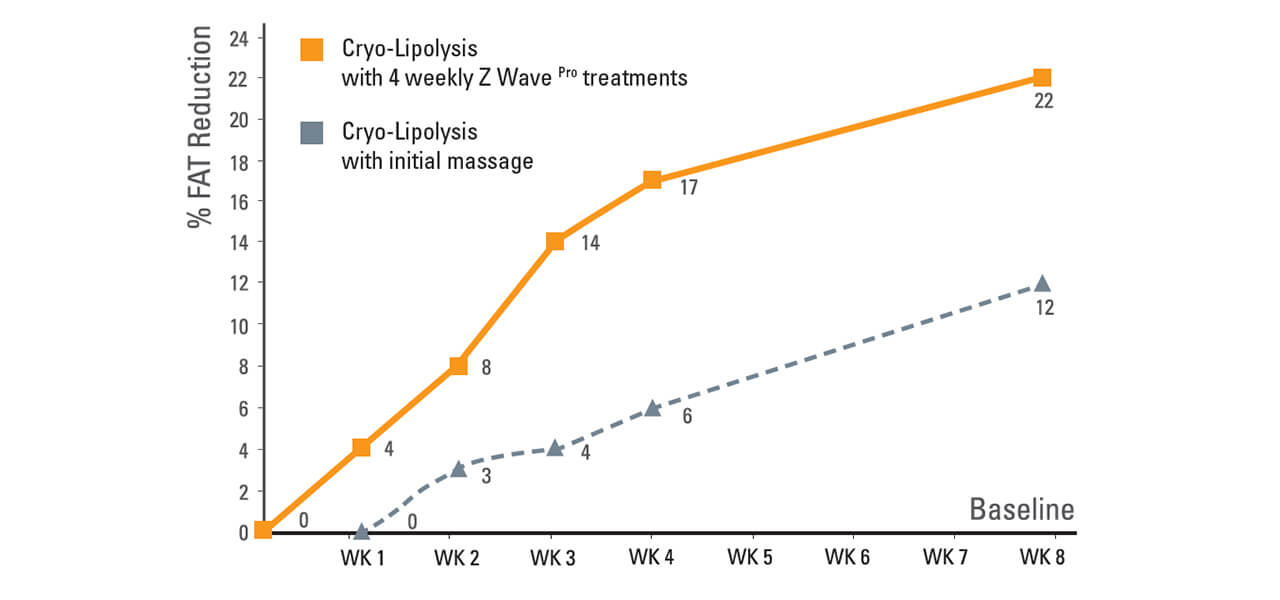 Chart-Z-lipo-and-Z-wave