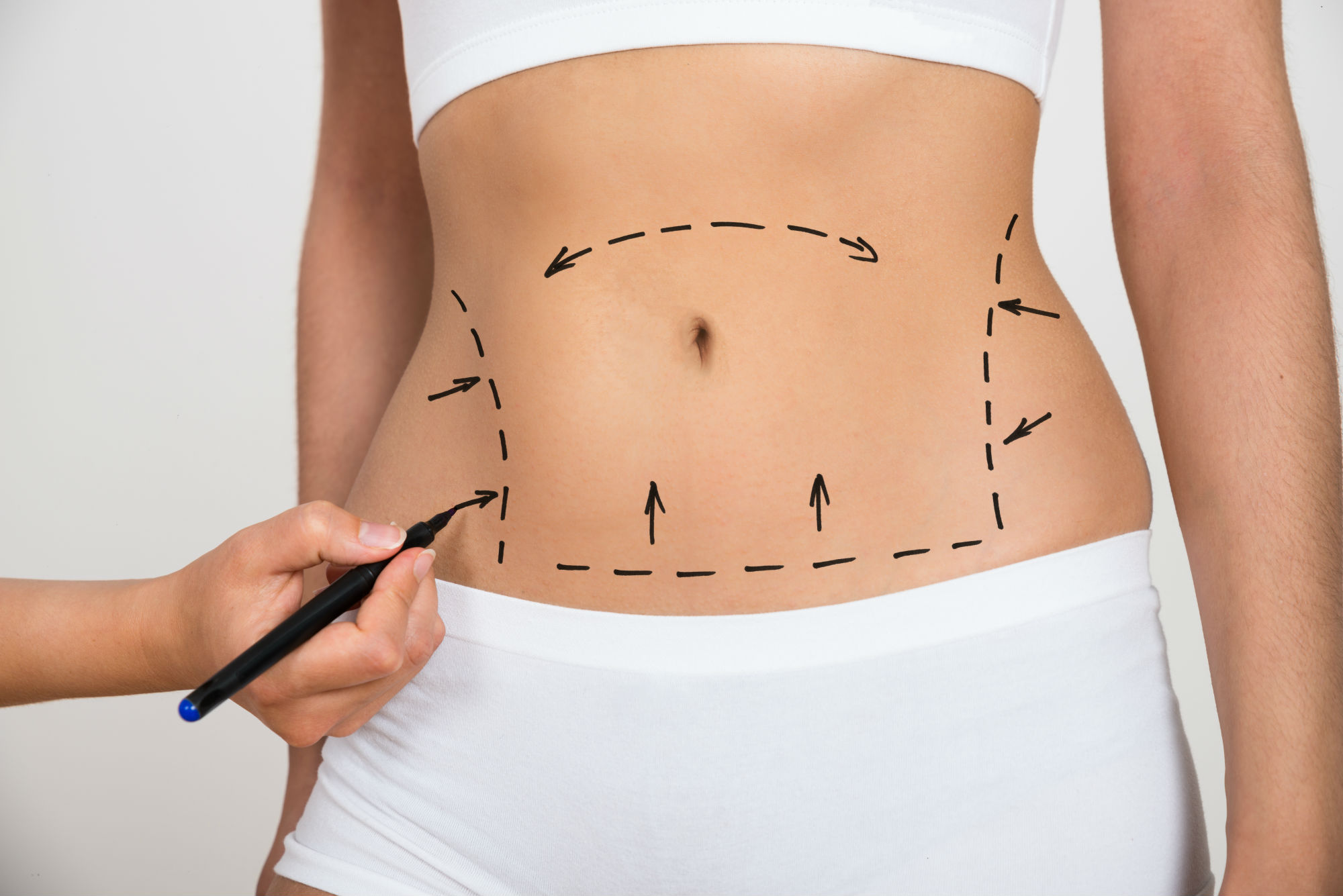 5 Ways for Skin Tightening in Singapore: Toning Loose Belly