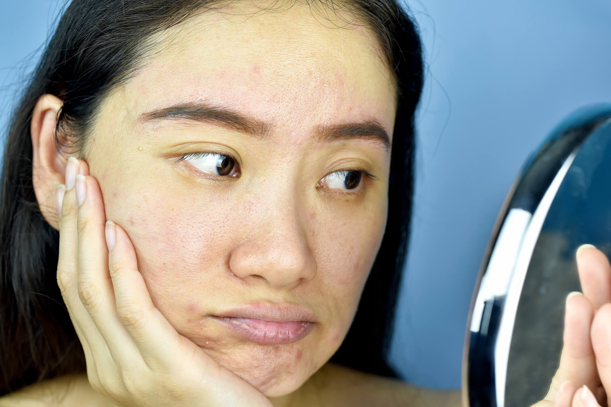 Clogged Pores Why It Happens And What You Can Do About It