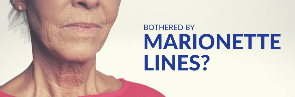 Marionette_Lines